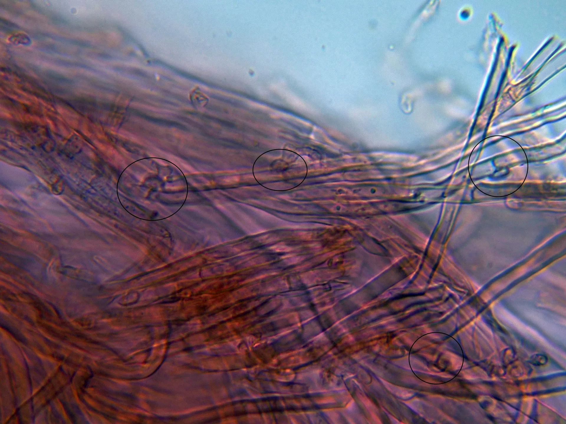 Microscopía de Trametopsis cervina - 10 - Hifas cutícula-003